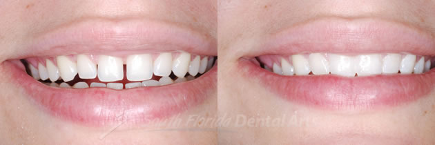 cosmetic-dentistry1.jpg