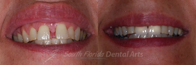 cosmetic-dentistry3.jpg
