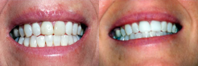dental-implants2.png